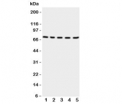 Western blot testing of NRG1 antibody and Lane 1: rat spleen;  2: (r) kidney;  3: (r) brain;  4: human HeLa;  5: (h) SMMC-7721 cell lysate. Predicted/observed molecular weight: ~70 kDa.