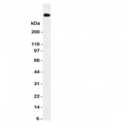 Western blot testing of DNA PKcs antibody and HeLa cell lysate.  Predicted/observed size ~460KD
