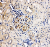 IHC staining of FFPE rat liver tissue with TJP2 antibody. HIER: boil tissue sections in pH8 EDTA for 20 min and allow to cool before testing.