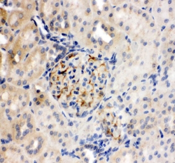 IHC-P: TJP2 antibody testing of mouse liver tissue