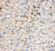 IHC staining of FFPE mouse liver tissue with TJP2 antibody. HIER: boil tissue sections in pH8 EDTA for 20 min and allow to cool before testing.