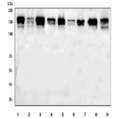 Western blot testing of 1) human RT4, 2) human A431, 3) human HepG2, 4) human MCF7, 5) human U-2 OS, 6) human HeLa, 7) human PC-3, 8) rat RH35 and 9) mouse HEPA1-6 cell lysate with TJP2 antibody.  Expected molecular weight: 131-160 kDa.
