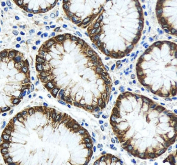 IHC staining of FFPE human stomach tissue with TJP2 antibody, HRP-secondary and DAB substrate. HIER: boil tissue sections in pH8 EDTA for 20 min and allow to cool before testing.