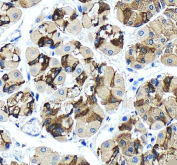 IHC staining of FFPE human stomach tissue with TJP2 antibody, HRP-secondary and DAB substrate. HIER: boil tissue sections in pH8 EDTA for 20 min and allow to cool before testing.