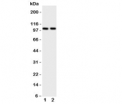Western blot testing of ZO-3 antibody and Lane 1:  rat brain;  2: rat heart tissue lysate.  Predicted/observed size ~103KD