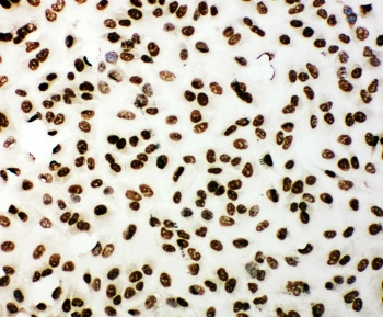 ICC testing of 53BP1 antibody and A549 cells