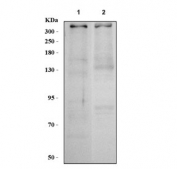 Western blot testing of human 1) HeLa and 2) RT4 cell lysate with 53BP1 antibody. Predicted molecular weight: ~214 kDa but may be observed at up to ~450 kDa.