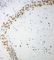 IHC-P: 53BP1 antibody testing of mouse brain tissue. HIER: steamed with pH6 citrate buffer.