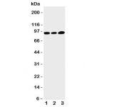 Western blot testing of TRPV3 antibody and Lane 1:  HeLa;  2: A549;  3: MCF-7 cell lysate.  Predicted/observed size ~90KD