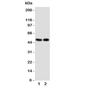 Western blot testing of VDR antibody and Lane 1: MCF-7; 2: HeLa cell lysate. Predicted/expected size ~50KD