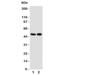 Western blot testing of VDR antibody and Lane 1:  MCF-7;  2: HeLa cell lysate.  Predicted molecular weight 48/54 kDa (isoforms 1/2).
