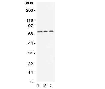 Western blot testing of VGF antibody and Lane 1: human U87; 2: (h) SHG-44; 3: mouse Neuro-2a cell lysate. Expected size ~90KD (unprocessed), ~70KD (processed)