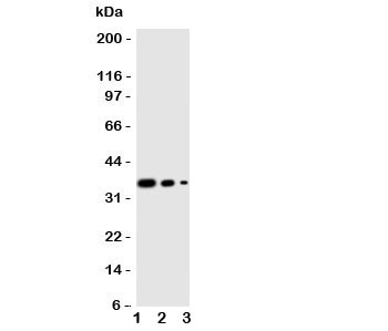 Western blot testing of WNT2B antibody and human recombinant protein, 36KD with tag; Lane 1: 10ng; 2. 5ng; 3. 2.5ng