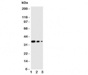 Western blot testing of WNT2B antibody and human recombinant protein, 36KD with tag;  Lane 1: 10ng;  2. 5ng;  3. 2.5ng