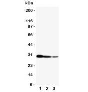 Western blot testing of CRTC2 antibody and human recombinant protein, 29KD with tag;  Lane 1:10ng;  2: 5ng;  3: 2.5ng