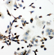 ICC testing of VEGFR2 antibody and HeLa cells