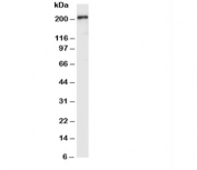 Western blot testing with VEGFR2 antibody and SMMC-7721 lysate. Predicted molecular weight: ~152 (immature), 180-200 kDa (intermediate) and 220-230 kDa (mature).