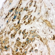 IHC-F testing of VEGFR2 antibody and human placenta tissue