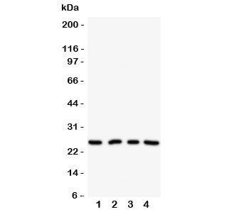 Western blot testing of NPM2 antibody on Lane 1: HeLa; 2: U87; 3: A549; 4: SMMC-7721 cell lysate. Predicted/observed size ~24KD