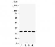 Western blot testing of NPM2 antibody on Lane 1: HeLa;  2: U87;  3: A549;  4: SMMC-7721 cell lysate. Predicted/observed size ~24KD
