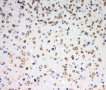 IHC-P: TrkC antibody testing of rat brain tissue