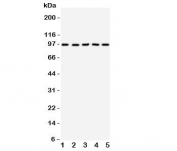 Western blot testing of TRKC antibody on Lane 1: rat brain;  2: mouse brain;  3: human U87;  4: (h) SHG-44;  5: (m) Neuro-2a cell lysate.  Observed molecular weight 95~145 kDa depending on glycosylation level.