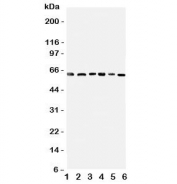 Western blot testing of PDK1 antbody on Lane 1: rat heart;  2: (r) skeletal muscle; and human samples 3: HeLa;  4: M231;  5: COLO320;  6: SW620 cell lysate. Predicted molecular weight ~49 kDa, observed here at ~64 kDa.