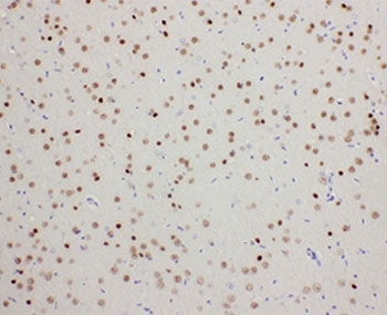 IHC-P: PDK2 antibody testing of rat brain tissue