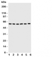 Western blot testing of SCYL antbody on Lane 1: U87;  2: HeLa;  3: 293T;  4: MCF-7;  5: COLO320;  6: HE1080 cell lysate