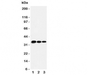 Western blot testing of T-bet antbody and human recombinant protein, 35KD with tag;  Lane 1: 5ng;  2: 2.5ng;  3: 1.25ng