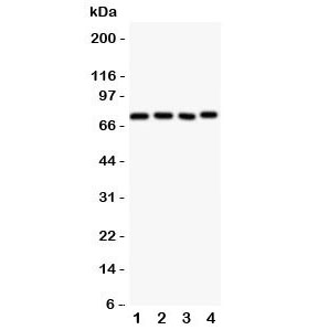Western blot testing of Tec antbody; Lane 1: rat liver; 2: (r) spleen; 3: (r) kidney; 4: human HeLa; 5: (h) Jurkat cell lysate. Expected/observed size ~73KD