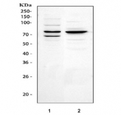 Western blot testing of Tec antbody; Lane 1: rat liver;  2: (r) spleen;  3: (r) kidney;  4: human HeLa;  5: (h) Jurkat cell lysate. Predicted molecular weight ~73 kDa.