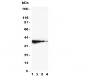 Western blot testing of TRIF antibody and mouse recombinant protein, 37.5KD with tag;  Lane 1: 10ng;  2: 5ng;  3: 2.5ng;  4: 1.25ng