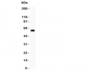 Western blot testing of DR3 antbody and COLO320 lysate. Predicted molecular weight: 45 kDa, observed at 50-70 kDa.