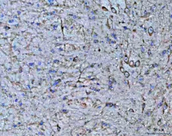 IHC staining of FFPE mouse brain tissue with Tollip antibody. HIER: boil tissue sections in pH8 EDTA for 20 min and allow to cool before testing.