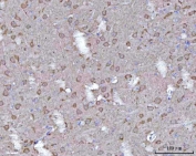IHC staining of FFPE rat brain tissue with Tollip antibody. HIER: boil tissue sections in pH8 EDTA for 20 min and allow to cool before testing.