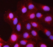 Immunofluorescent staining of FFPE human U-2 OS cells with Tollip antibody (red) and DAPI nuclear stain (blue). HIER: steam section in pH6 citrate buffer for 20 min.