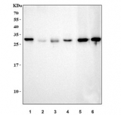 Western blot testing of 1) human RT4, 2) human U-2 OS, 3) human SW620, 4) human HeLa, 5) rat brain and 6) mouse brain lysate with Tollip antibody.  Expected molecular weight ~30 kDa.