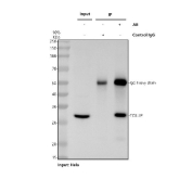 Immunoprecipitation of Tollip protein from 500ug of human HeLa whole cell lysate with 2ug of Tollip antibody.
