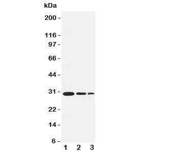 Western blot testing of TRAF1 antbody and recombinant human protein, 30.6KD with tag; Lane 1: 5ng; 2: 2.5ng; 3: 1.25ng