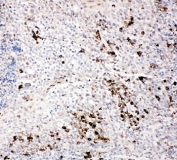 IHC-P: TRAF2 antibody testing of human tonsil tissue. HIER: steamed with pH6 citrate buffer.