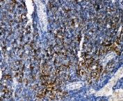 IHC-P: TRAF4 antibody testing of rat lymphonodus tissue. HIER: steamed with pH6 citrate buffer.