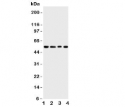 Western blot testing of TRAF4 antbody;  Lane 1: rat thymus;  2: human HeLa;  3: (h) Jurkat;  4: mouse HEPA cell lysate.  Predicted molecular weight: ~54 kDa.