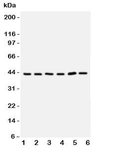 Western blot testing of TRAM antbody; Lane 1: rat brain; 2: (r) kidney; 3: human 293T; 4: (h) Raji; 5: (h) Jurkat cell lysate. Expected/observed size ~43KD