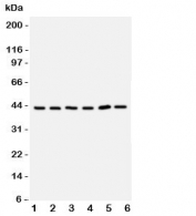 Western blot testing of TRAM antbody;  Lane 1: rat brain;  2: (r) kidney;  3: human 293T;  4: (h) Raji;  5: (h) Jurkat cell lysate.  Predicted molecular weight ~43 kDa but may be observed at higher molecular weights due to glycosylation.