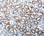IHC-P: TRAM antibody testing of rat kidney tissue. HIER: steamed with pH6 citrate buffer.