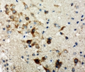 IHC-P: TSC1 antibody testing of rat brain tissue