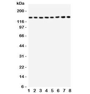 Western blot testing of TSC1 antbody and rat samples: 1. skeletal muscle; 2. heart; 3. brain; 4. lung; and human samples: 5. 293T; 6. HeLa; 7. HT1080; 8. SMMC-7721. Expected/observed size 130KD~150KD
