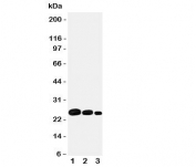 Western blot testing of Adiponectin antbody and recombinant protein;  Lane 1: 10ng;  2: 5ng;  3:  2.5ng