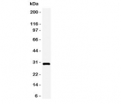 Western blot testing of Adiponectin antbody and rat heart tissue lysate.  Expected/observed size ~30KD
